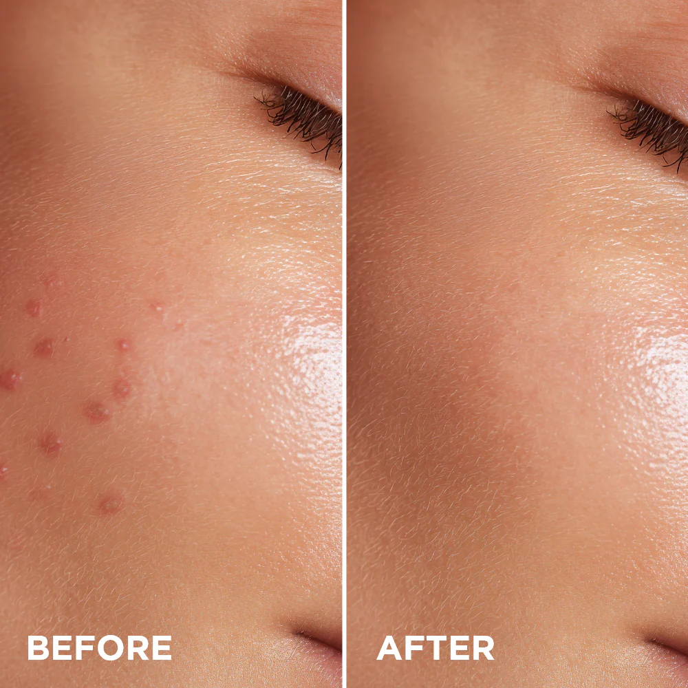 Anti-blemish serum - Image 3