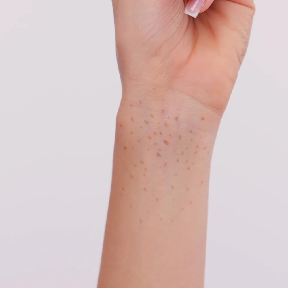 Freckle pen - Image 2