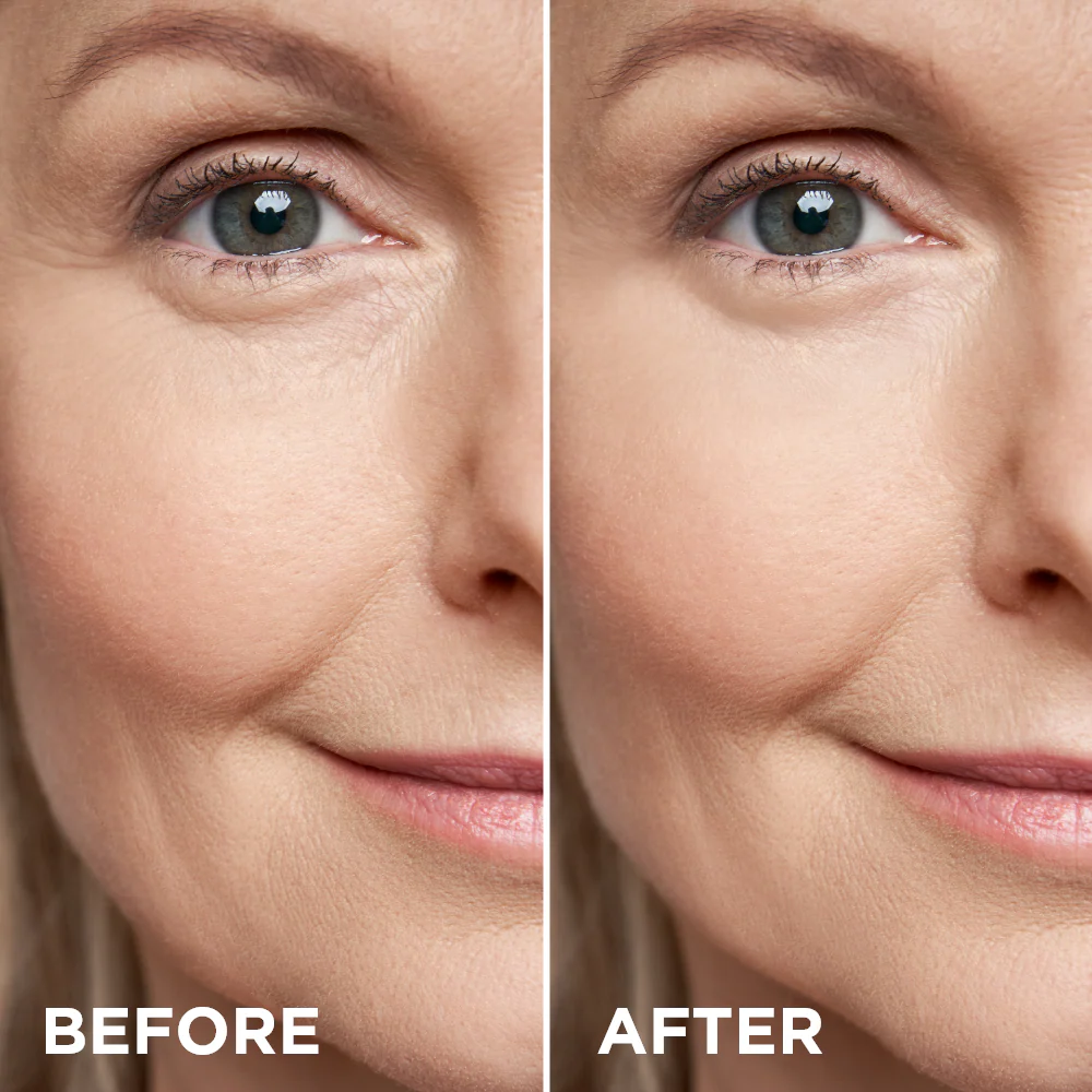 Gold cream–nourishing mask 70+ - Image 3