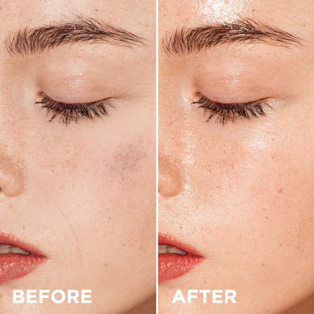 Rejuvenating peptide meso-serum - Image 3